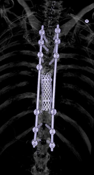 Slide 45